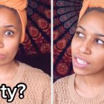 This Woman With Genital Herpes Is Going Viral For Sharing Her Experience And Spreading Awareness